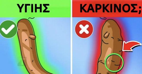 Τι αποκαλύπτει το χρώμα των κοπράνων σας για την υγεία σας
