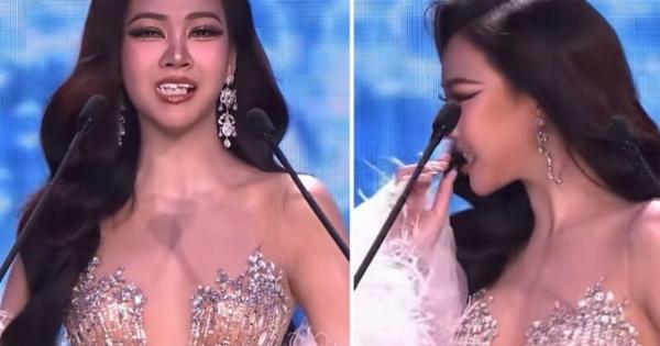 Απρόοπτο σε καλλιστεία: Έπεσαν τα «ψεύτικα» δόντια διαγωνιζόμενης – H αντίδρασή της κέρδισε το κοινό