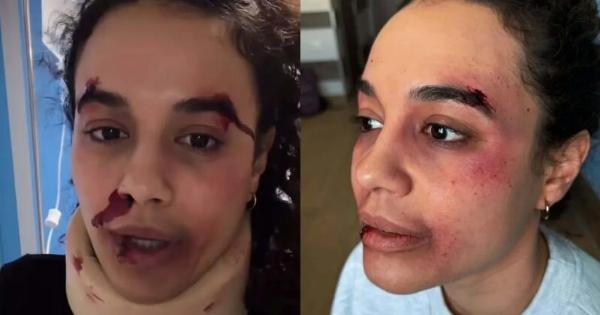 Πηνελόπη Πλάκα: «Πήρα έτσι τη μαμά μου, το ξέρω ήτανε χοντρό»