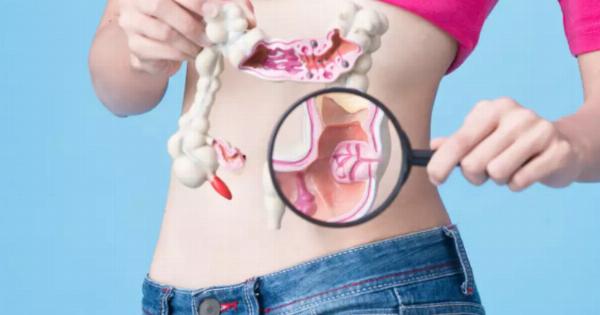 Τόσο καιρό χρειάζεται ένας πολύποδας του εντέρου για να εξελιχθεί σε καρκίνο