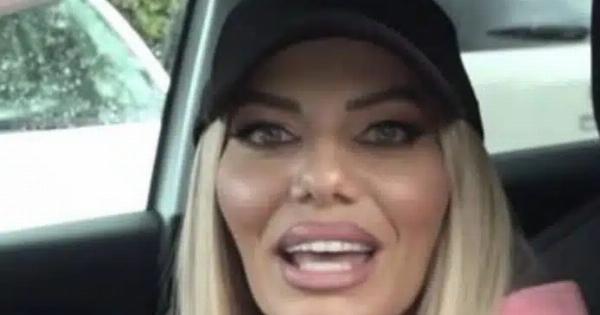 Αγνώριστη πασίγνωστη Ελληνίδα – Έγινε άλλος… άνθρωπος από τις επεμβάσεις