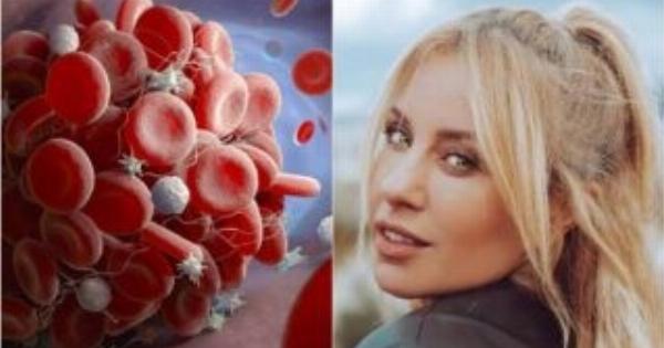 Πέθανε από λευχαιμία η Γωγώ Μαστροκώστα: Τι είναι ο καρκίνος στο αίμα, τα ύπουλα συμπτώματα και οι θεραπείες