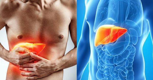 Λίπος στο συκώτι: Τι να τρώτε για να το μειώσετε χωρίς φάρμακα -Τροφές που πρέπει να αποφεύγετε