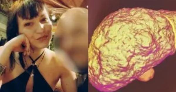 Κολωνός: Τι είναι η κίρρωση του ήπατος που «έδειξε» η ιατροδικαστική στην 31χρονη