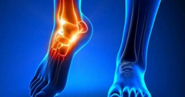 Ο χυμός που διαλύει το ουρικό οξύ στις αρθρώσεις