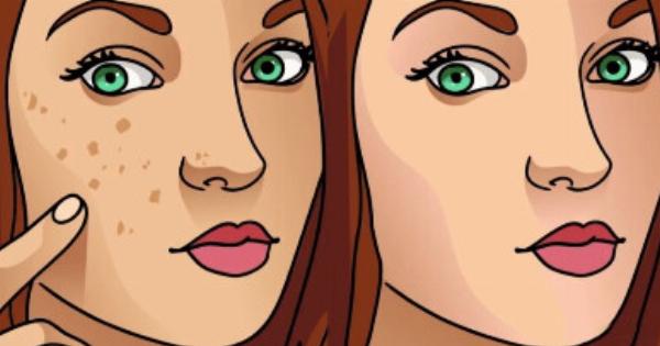 Λεύκανση επιδερμίδας: Πως να λευκάνετε φυσικά το δέρμα σας και να αντιμετωπίσετε τα σημάδια της γήρανσης