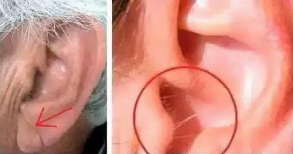 Να γιατί μεγαλώνουν τρίχες στα αυτιά σας