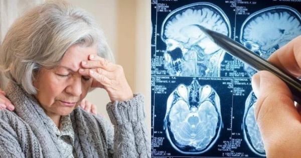 Άνοια: Η πασiγνωστη βιταμiνη που σώζει το μυαλό των 80ρηδων