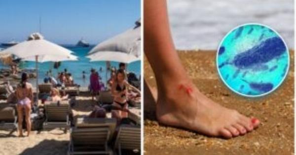 Συναγερμός στις παραλίες: Το «σαρκοφάγο βακτήριο» που εξαπλώνεται λόγω καύσωνα – Πού εντοπίζεται και τι πρέπει να ξέρεις πριν βουτήξεις