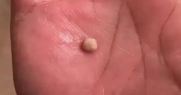 Να τι πρέπει να γνωρίζετε για αυτές τις πέτρες – Που εμφανίζονται